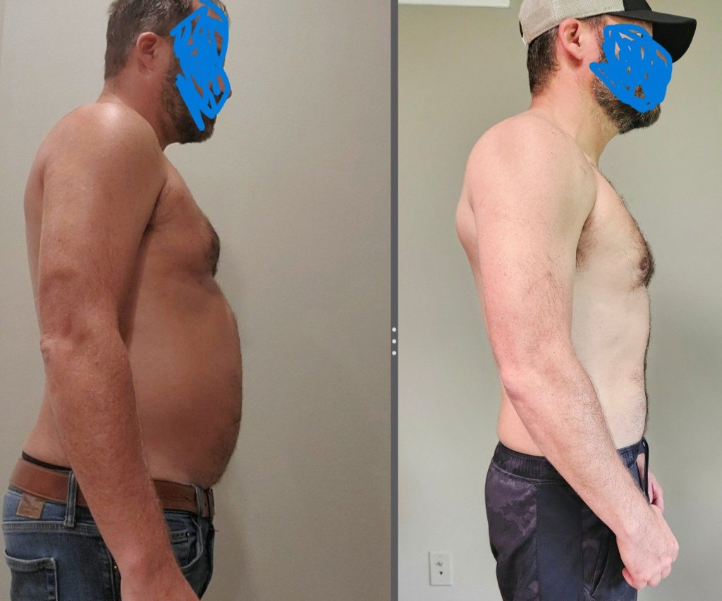 Why You Haven’t Been Able to Lose Weight — And How to Finally Lose 20 Pounds Before Summer