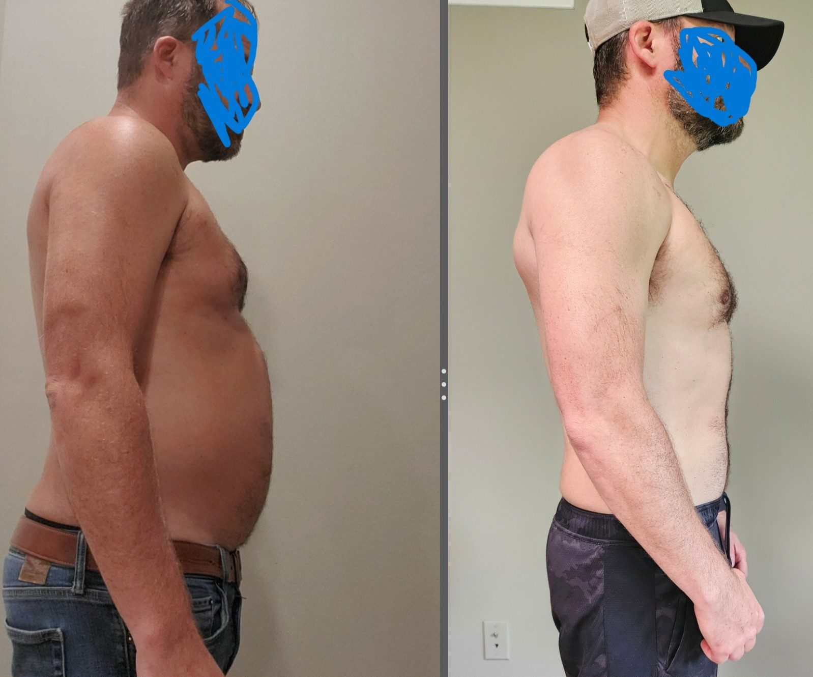 Why You Haven’t Been Able to Lose Weight — And How to Finally Lose 20 Pounds Before Summer